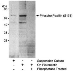 Detection of mouse phospho Paxillin (Ser178) by western blot.