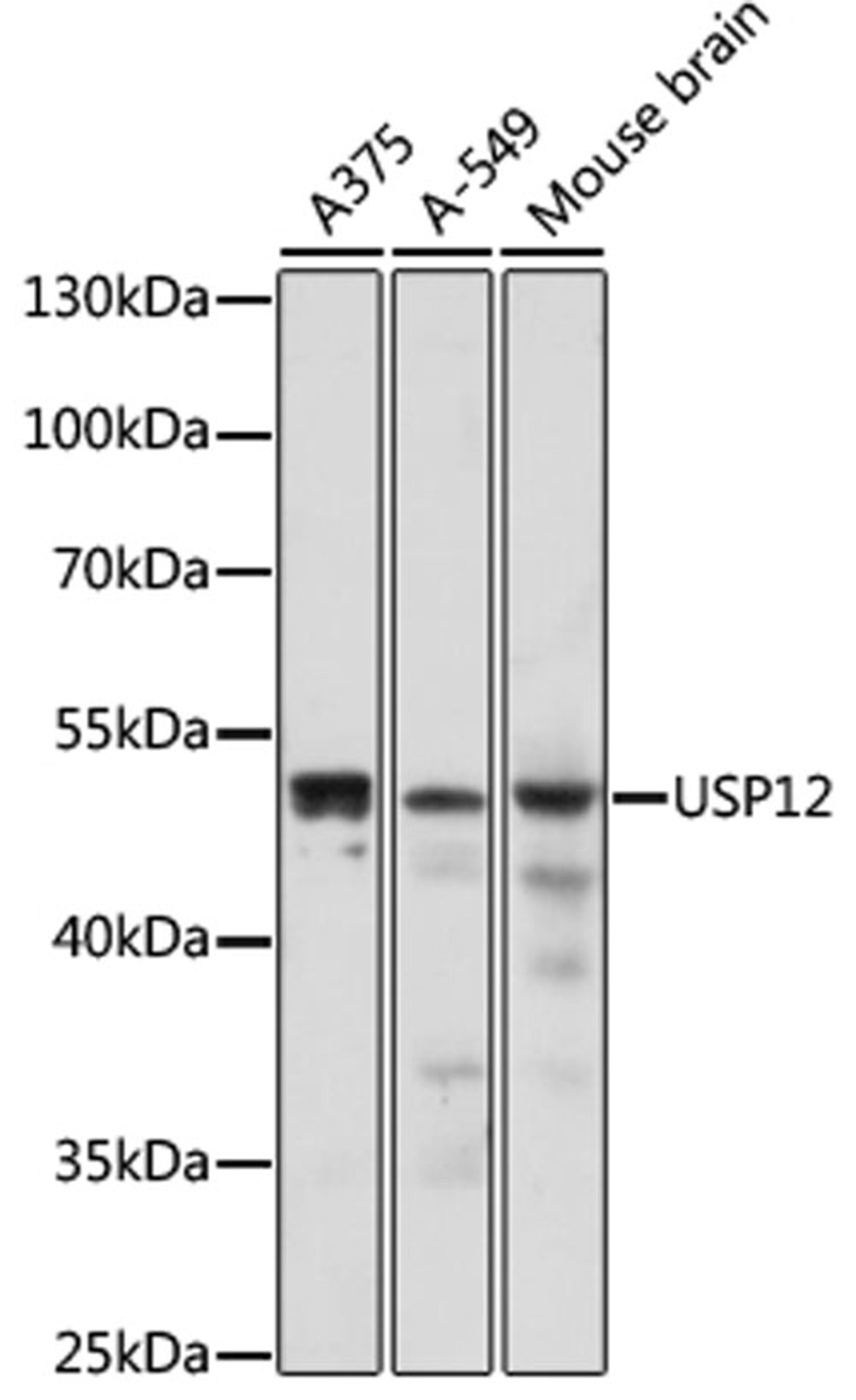 Western blot - USP12 antibody (A17862)