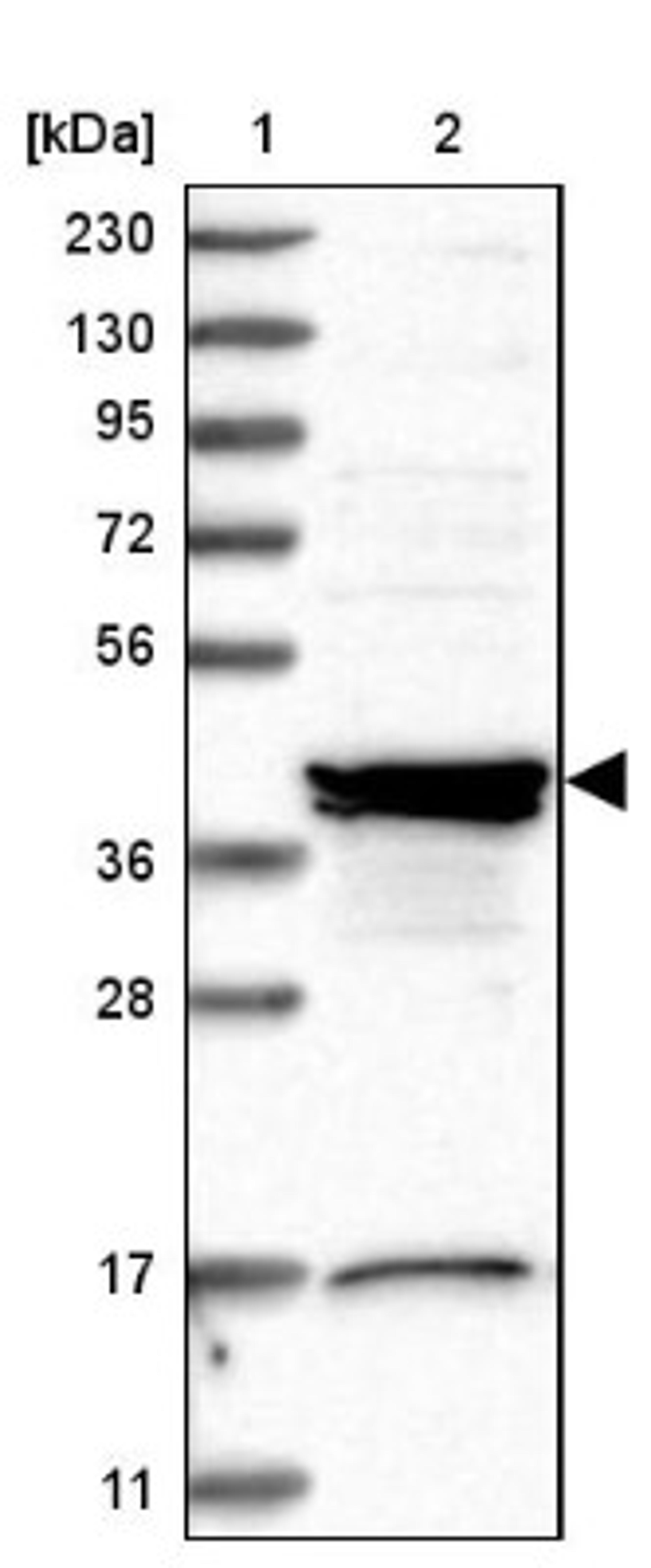 Western Blot: Sorting Nexin 31 Antibody [NBP1-92423] - Lane 1: Marker [kDa] 230, 130, 95, 72, 56, 36, 28, 17, 11<br/>Lane 2: Human cell line RT-4