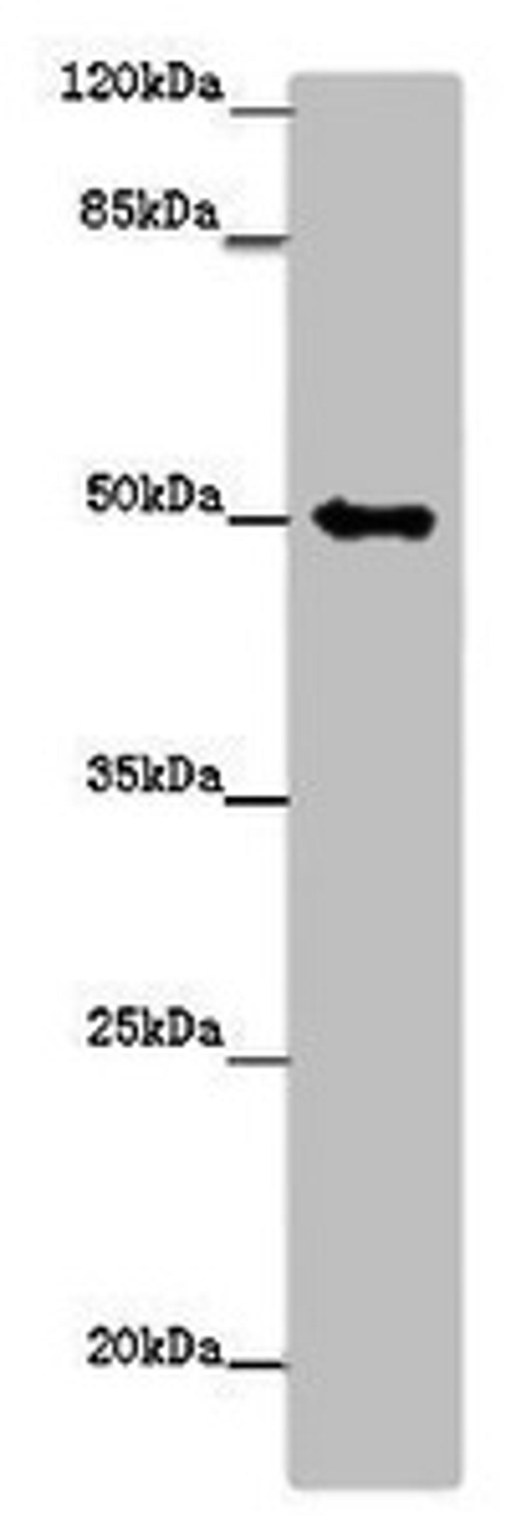 Western blot. All lanes: TUBG1 antibody at 14ug/ml + Hela whole cell lysate. Secondary. Goat polyclonal to rabbit IgG at 1/10000 dilution. Predicted band size: 52 kDa. Observed band size: 52 kDa.