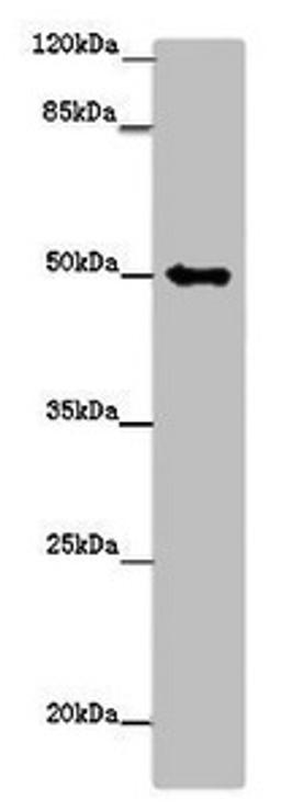 Western blot. All lanes: TUBG1 antibody at 14ug/ml + Hela whole cell lysate. Secondary. Goat polyclonal to rabbit IgG at 1/10000 dilution. Predicted band size: 52 kDa. Observed band size: 52 kDa.