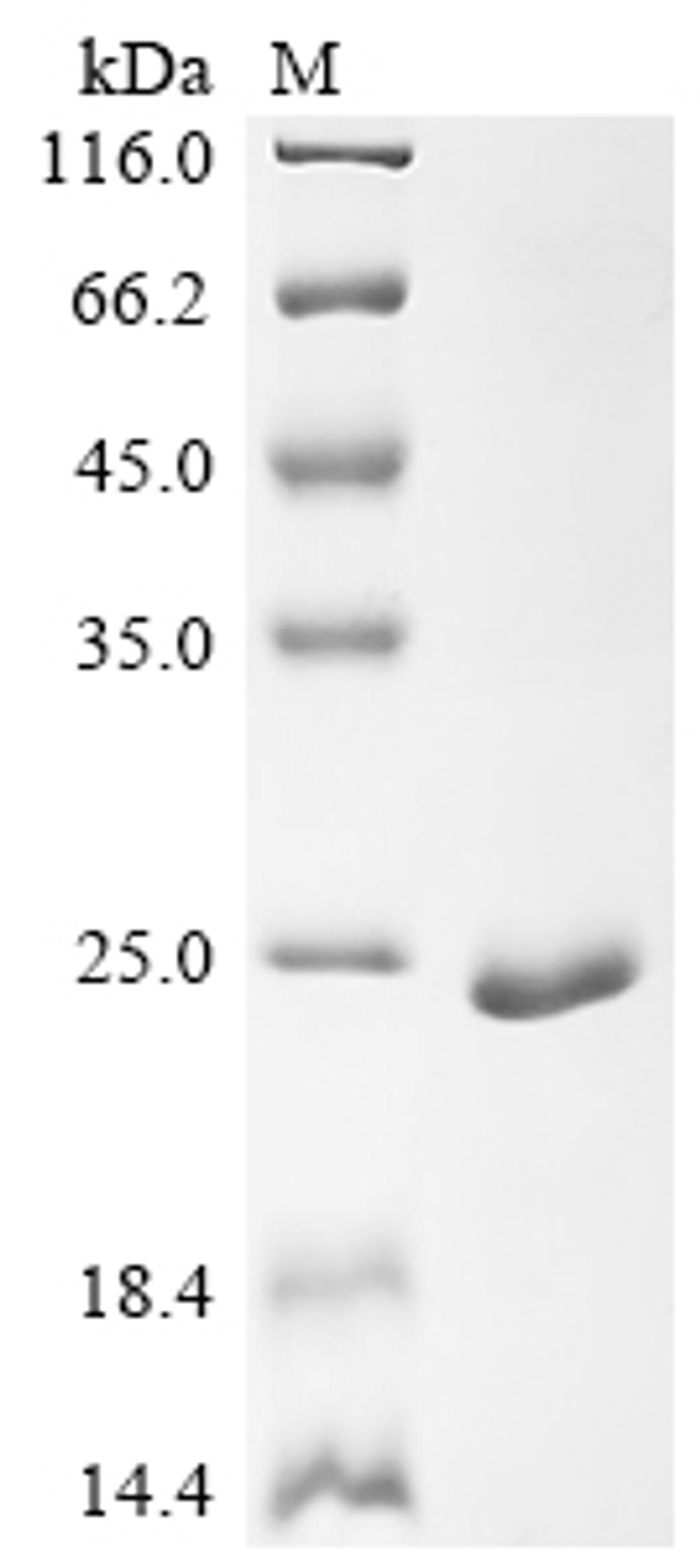 (Tris-Glycine gel) Discontinuous SDS-PAGE (reduced) with 5% enrichment gel and 15% separation gel.