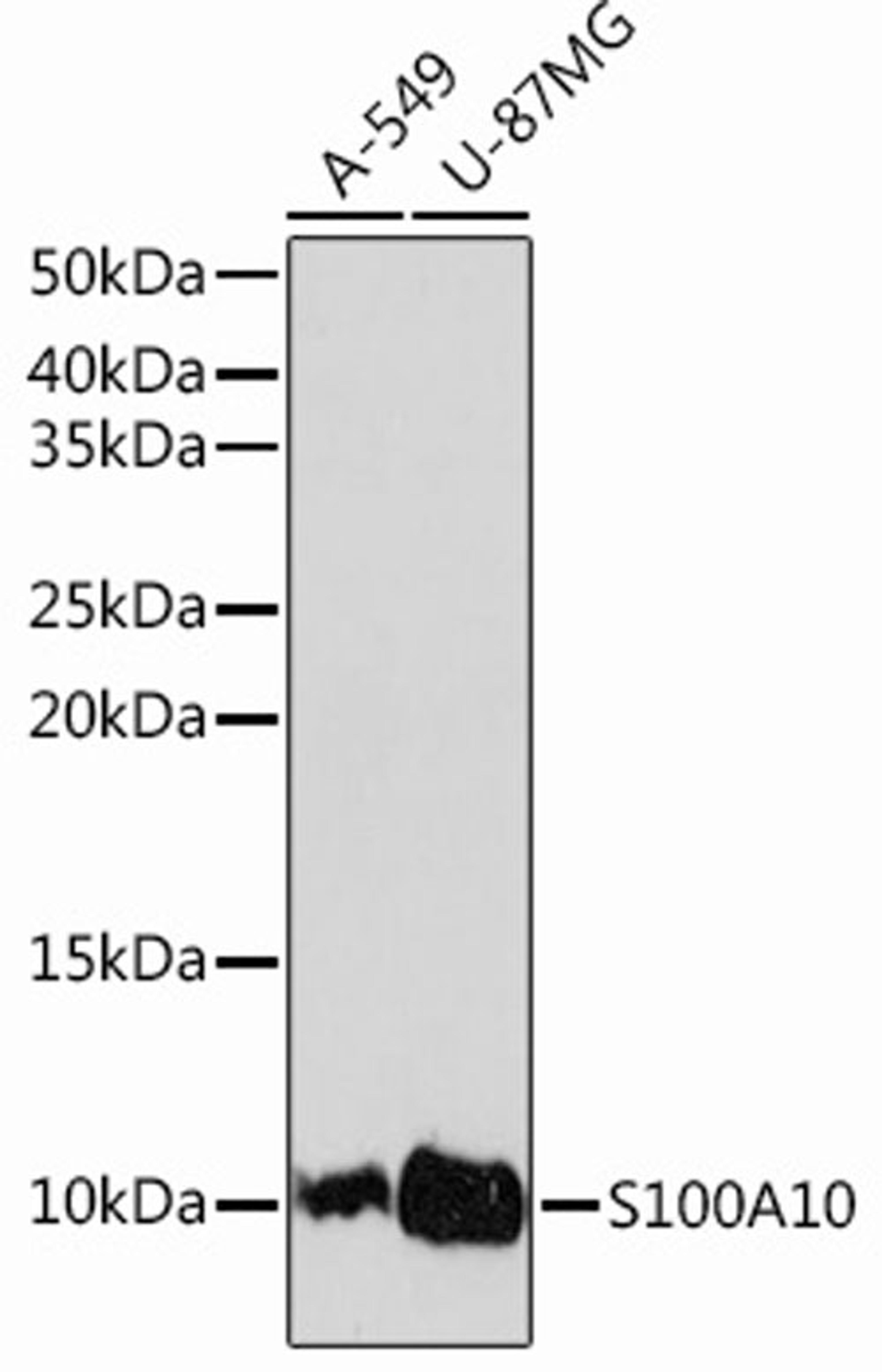 Western blot - S100A10 Rabbit mAb (A13614)