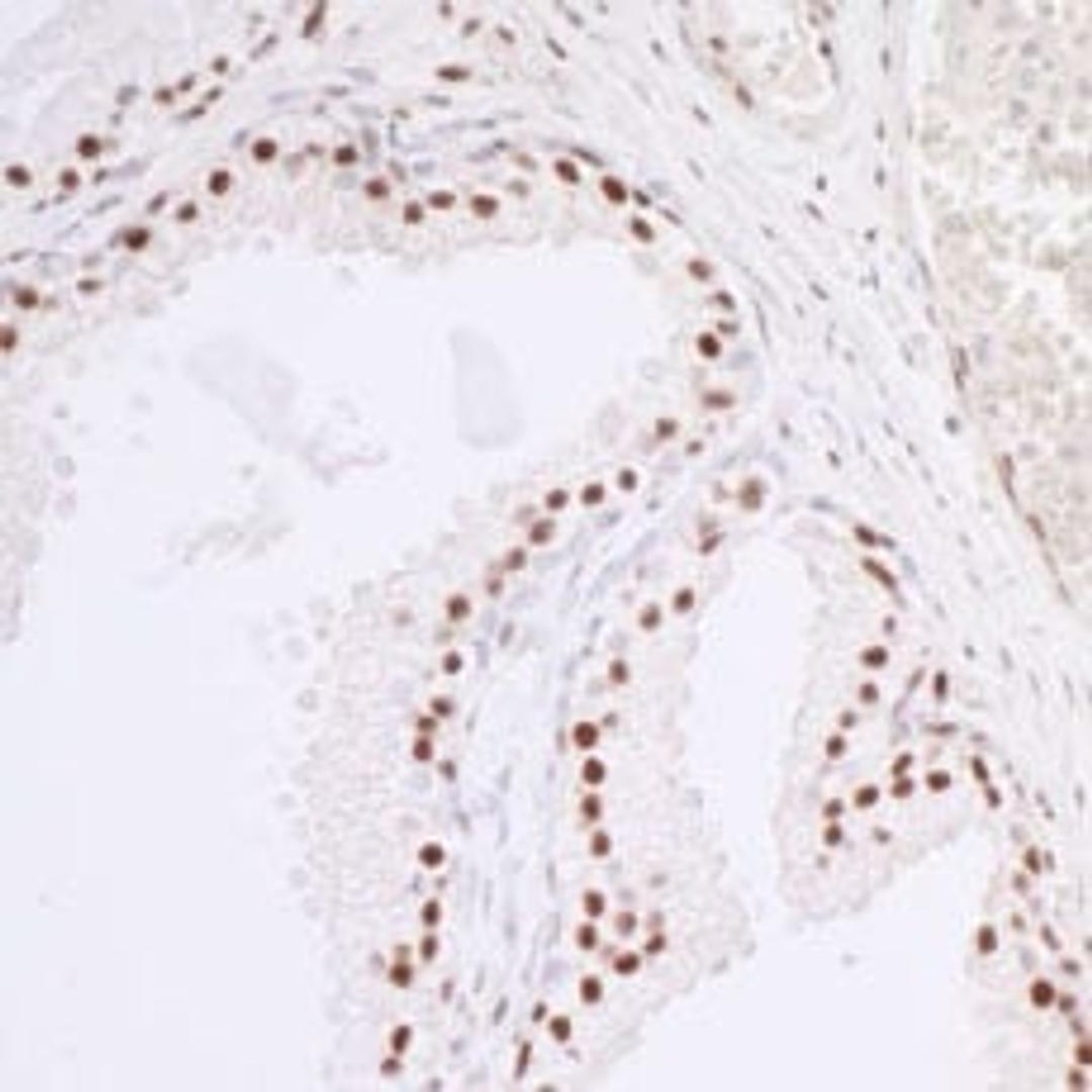 Detection of human Caper by immunohistochemistry.