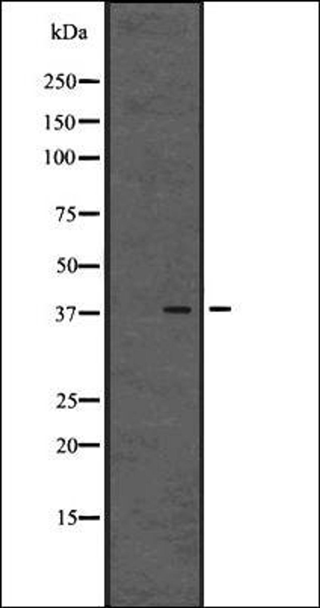 Western blot analysis of Human placenta tissue lysates using GPR80/GPR99 antibody