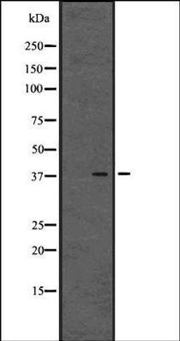 Western blot analysis of Human placenta tissue lysates using GPR80/GPR99 antibody