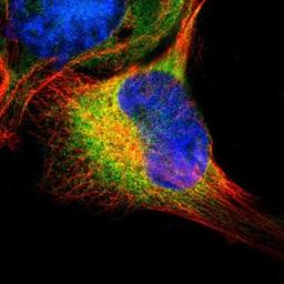 Immunocytochemistry/Immunofluorescence: SELS Antibody [NBP1-89558] - Staining of human cell line U-251MG shows positivity in endoplasmic reticulum.