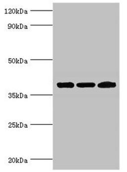 Western blot. All lanes: Twinfilin-2 antibody at 3ug/ml. Lane 1: Jurkat whole cell lysate. Lane 2: HepG2 whole cell lysate. Lane 3: A431 whole cell lysate. Secondary. Goat polyclonal to rabbit IgG at 1/10000 dilution. Predicted band size: 40 kDa. Observed band size: 40 kDa.