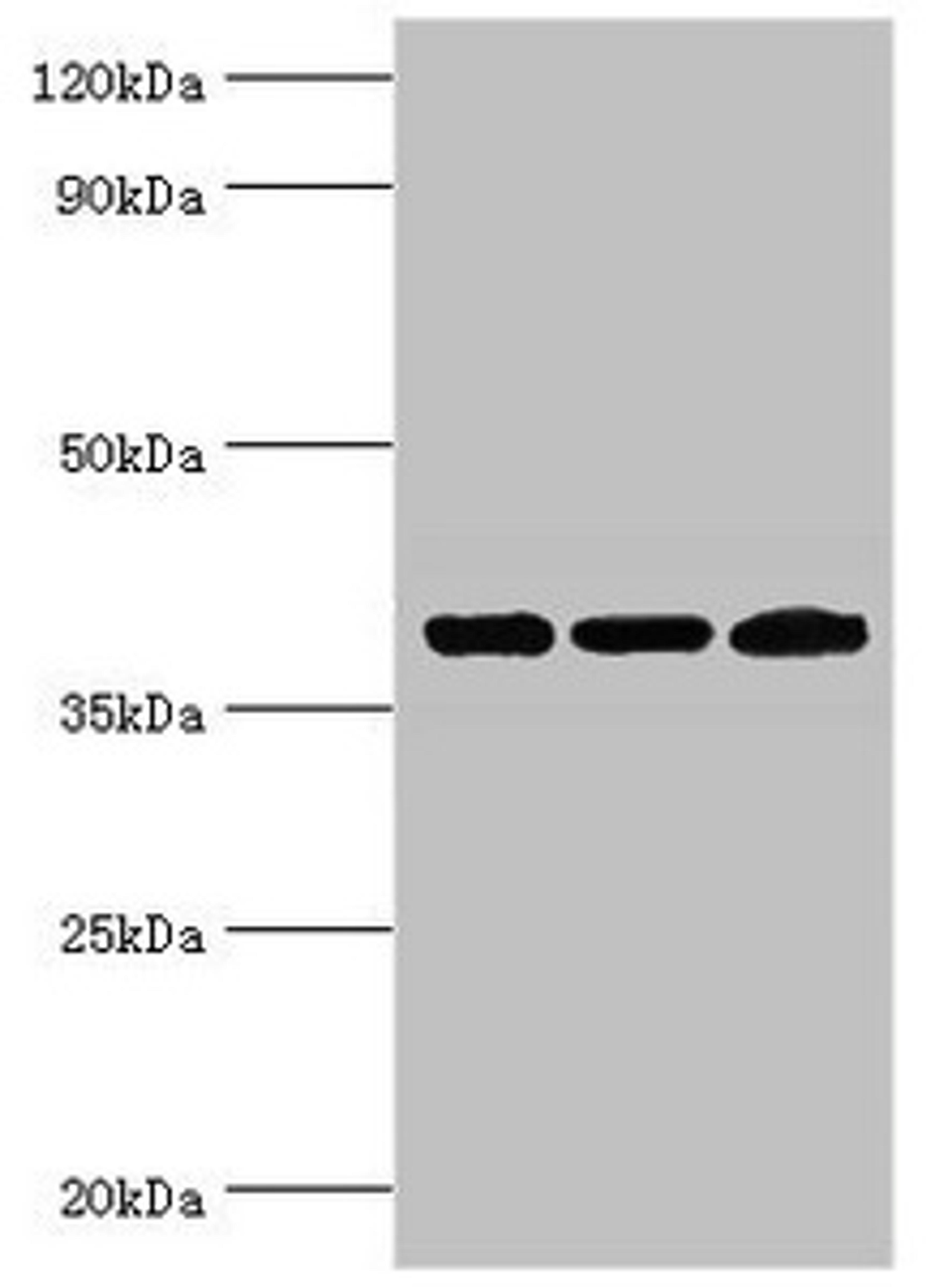 Western blot. All lanes: Twinfilin-2 antibody at 3ug/ml. Lane 1: Jurkat whole cell lysate. Lane 2: HepG2 whole cell lysate. Lane 3: A431 whole cell lysate. Secondary. Goat polyclonal to rabbit IgG at 1/10000 dilution. Predicted band size: 40 kDa. Observed band size: 40 kDa.