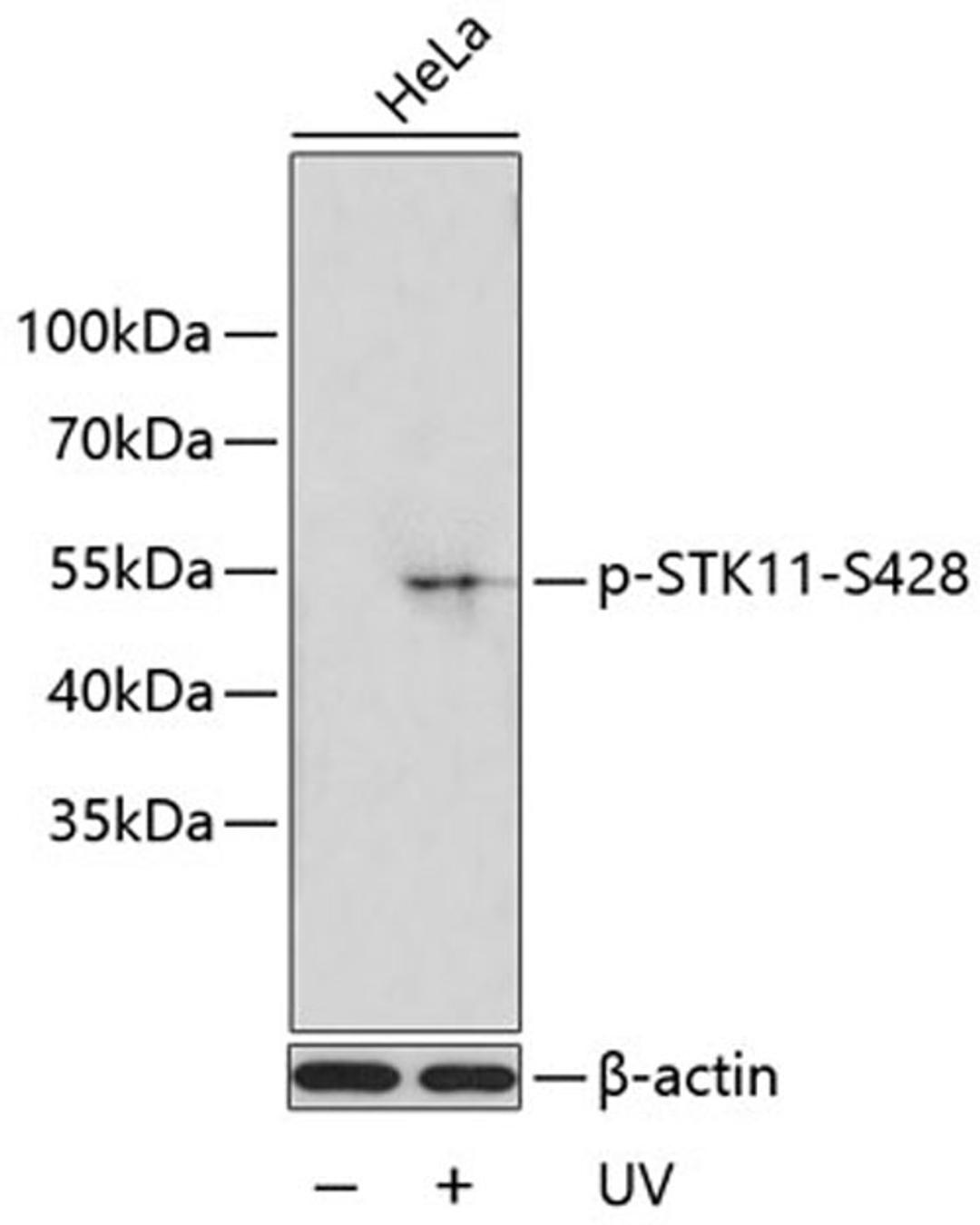 Western blot - Phospho-STK11-S428 antibody (AP0602)