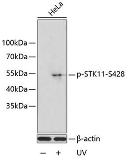 Western blot - Phospho-STK11-S428 antibody (AP0602)