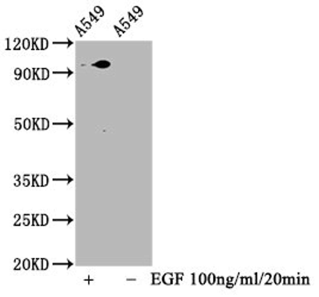Western Blot. Positive WB detected in A549 whole cell lysate(treated with EGF or not). All lanes Phospho-STAT3 antibody at 1.88μg/ml. Secondary. Goat polyclonal to rabbit IgG at 1/50000 dilution. Predicted band size: 98 KDa. Observed band size: 98 KDa.