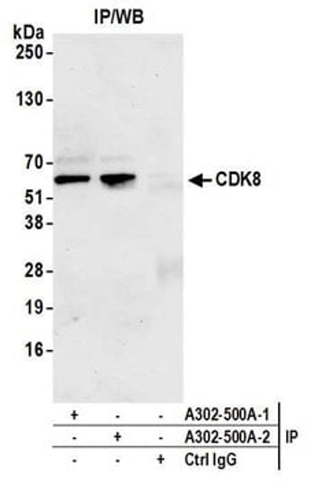 Detection of human CDK8 by western blot of immunoprecipitates.