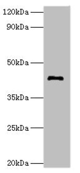 Western blot. All lanes: G/T mismatch-specific thymine DNA glycosylase antibody at 8ug/ml + Mouse brain tissue. Secondary. Goat polyclonal to rabbit IgG at 1/10000 dilution. Predicted band size: 46 kDa. Observed band size: 46 kDa. 