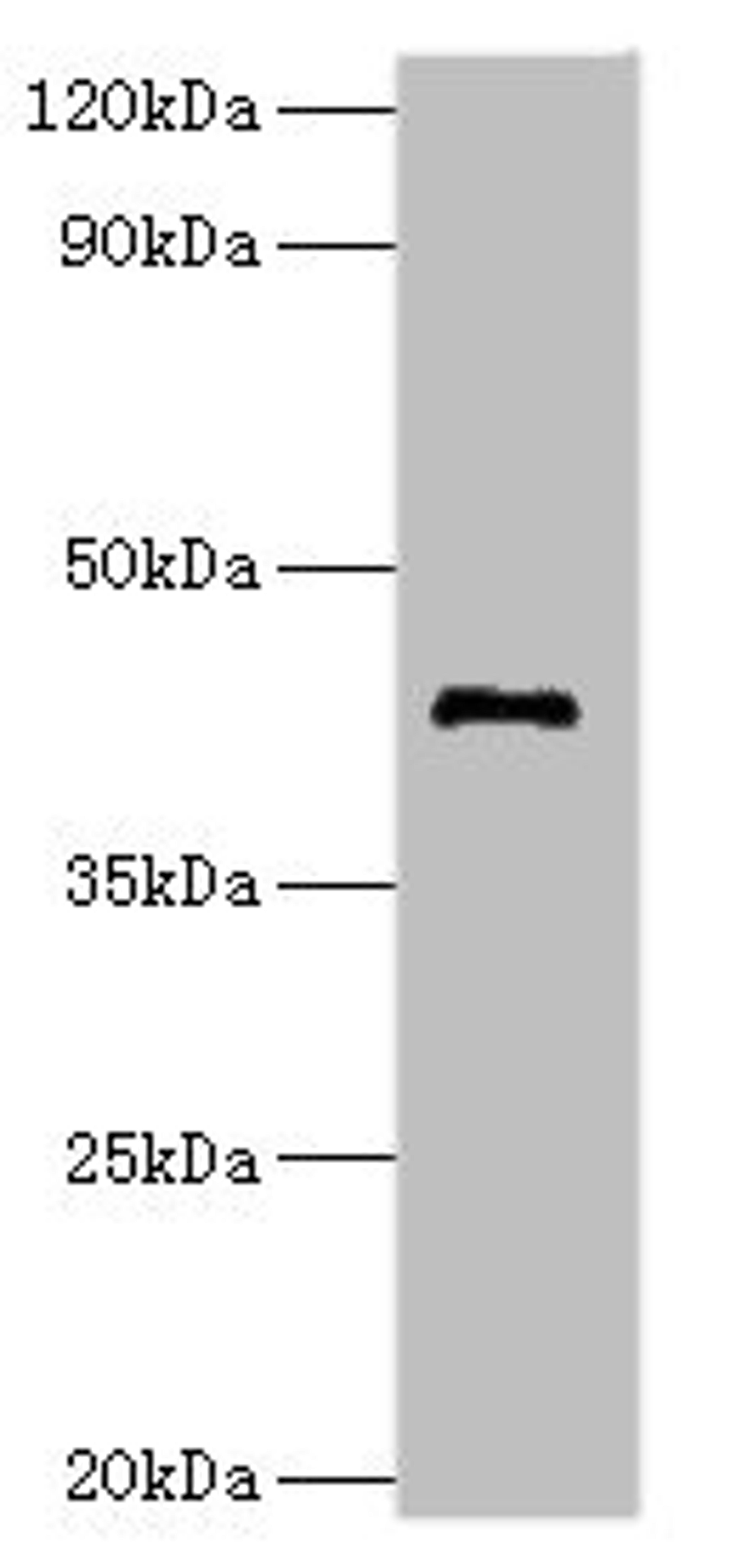 Western blot. All lanes: G/T mismatch-specific thymine DNA glycosylase antibody at 8ug/ml + Mouse brain tissue. Secondary. Goat polyclonal to rabbit IgG at 1/10000 dilution. Predicted band size: 46 kDa. Observed band size: 46 kDa. 