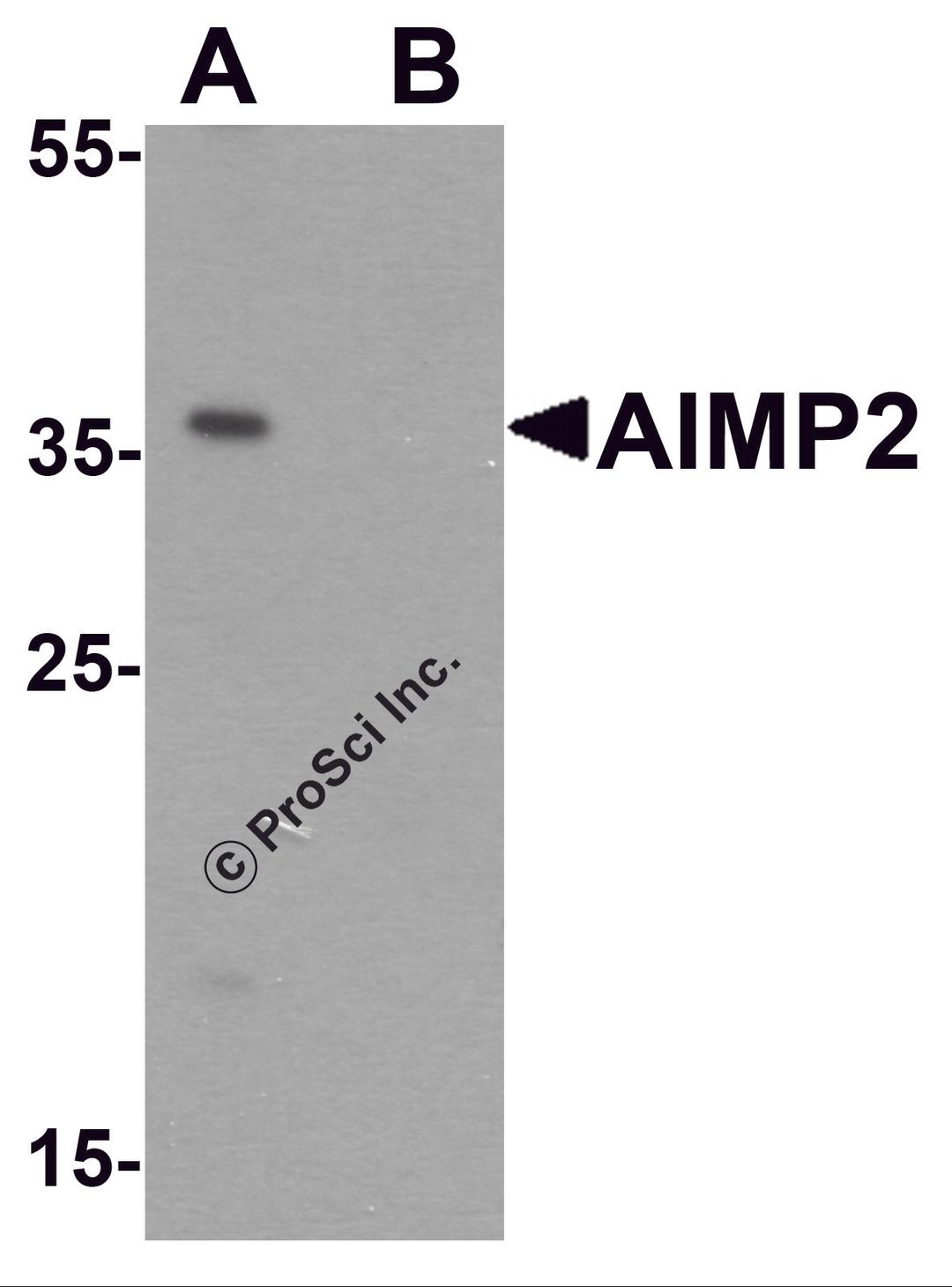 Western blot analysis of AIMP2 in HeLa cell lysate with AIMP2 antibody at 1 μg/ml in (A) the absence and (B) the presence of blocking peptide.