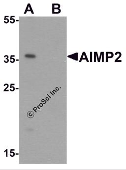 Western blot analysis of AIMP2 in HeLa cell lysate with AIMP2 antibody at 1 μg/ml in (A) the absence and (B) the presence of blocking peptide.