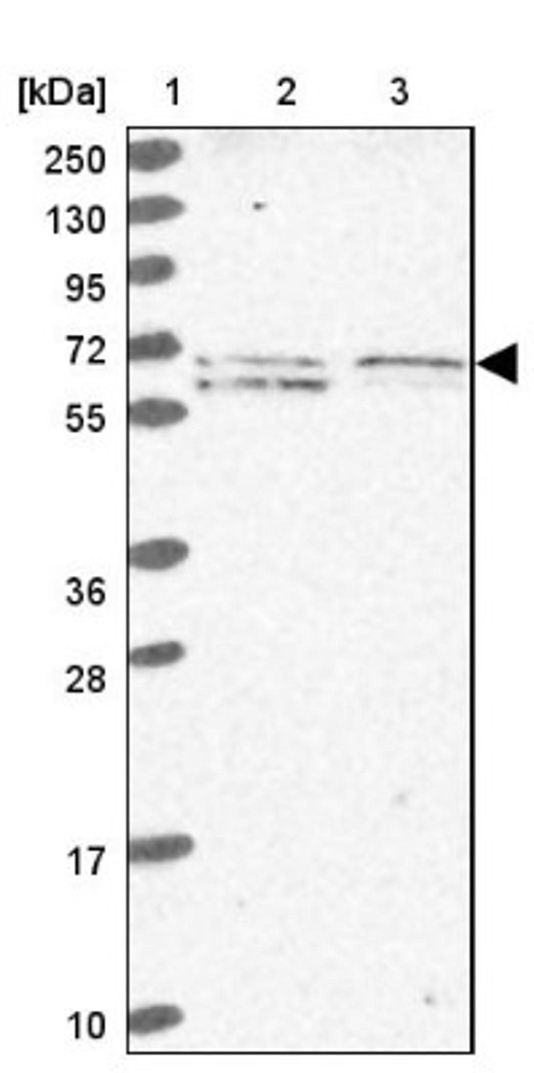 Western Blot: EHD3 Antibody [NBP2-31894] - Lane 1: Marker [kDa] 250, 130, 95, 72, 55, 36, 28, 17, 10<br/>Lane 2: Human cell line RT-4<br/>Lane 3: Human cell line U-251MG sp