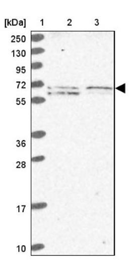 Western Blot: EHD3 Antibody [NBP2-31894] - Lane 1: Marker [kDa] 250, 130, 95, 72, 55, 36, 28, 17, 10<br/>Lane 2: Human cell line RT-4<br/>Lane 3: Human cell line U-251MG sp