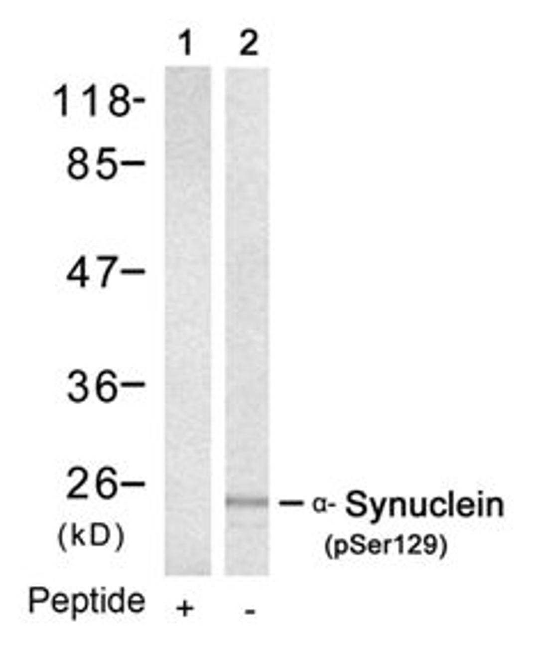 Western blot analysis of lysed extracts from mouse brain tissue using &#945;-Synuclein (Phospho-Ser129).