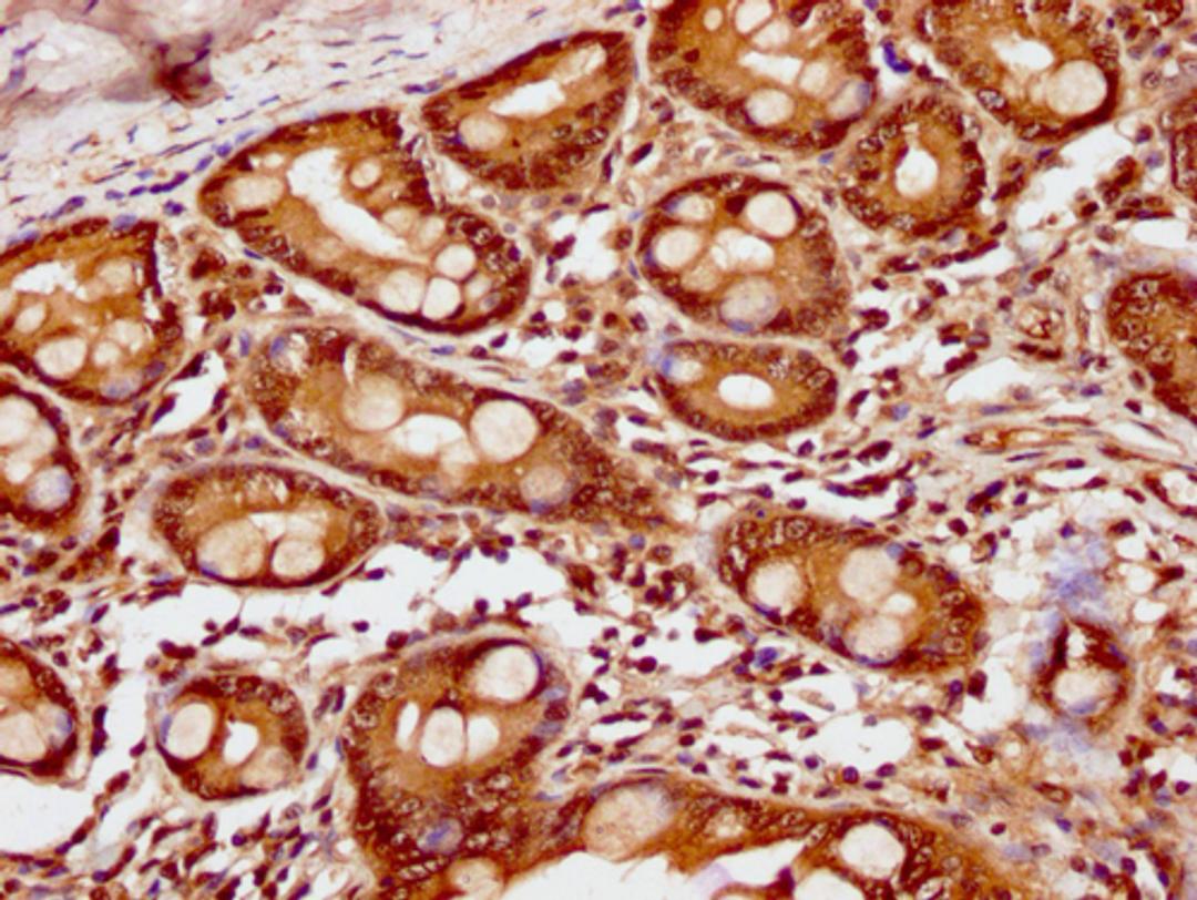 IHC image of CSB-PA010380OA63ncrHU diluted at 1:10 and staining in paraffin-embedded human small intestine tissue performed on a Leica BondTM system. After dewaxing and hydration, antigen retrieval was mediated by high pressure in a citrate buffer (pH 6.0). Section was blocked with 10% normal goat serum 30min at RT. Then primary antibody (1% BSA) was incubated at 4°C overnight. The primary is detected by a biotinylated secondary antibody and visualized using an HRP conjugated SP system.