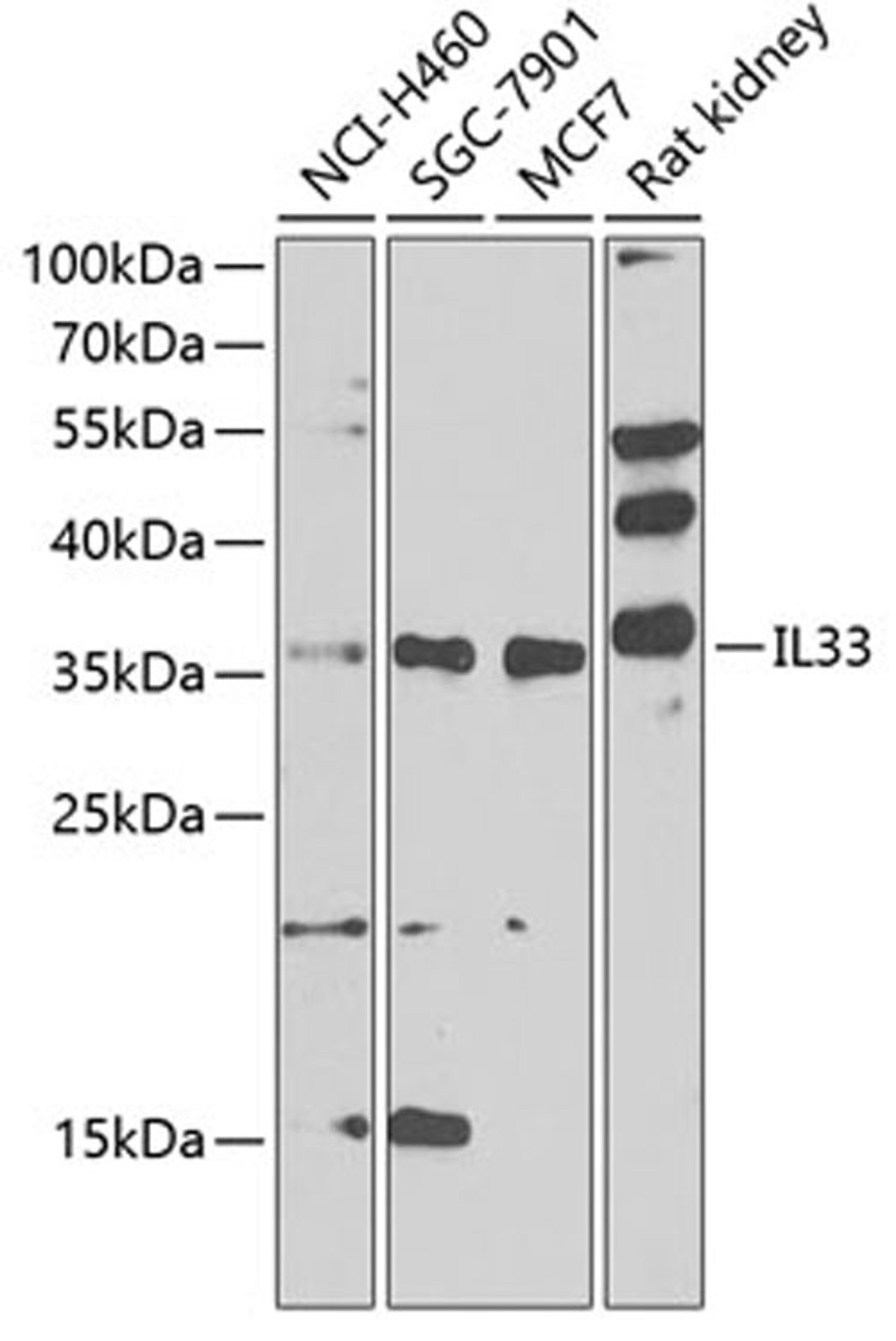 Western blot - IL33 antibody (A8096)