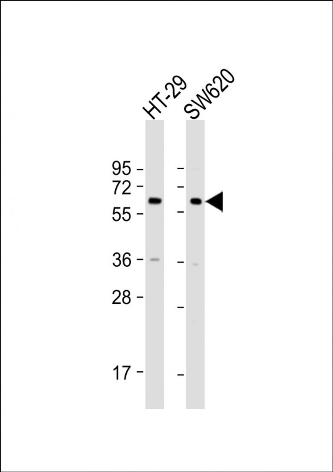 Western Blot at 1:2000 dilution Lane 1: HT-29 whole cell lysate Lane 2: SW620 whole cell lysate Lysates/proteins at 20 ug per lane.