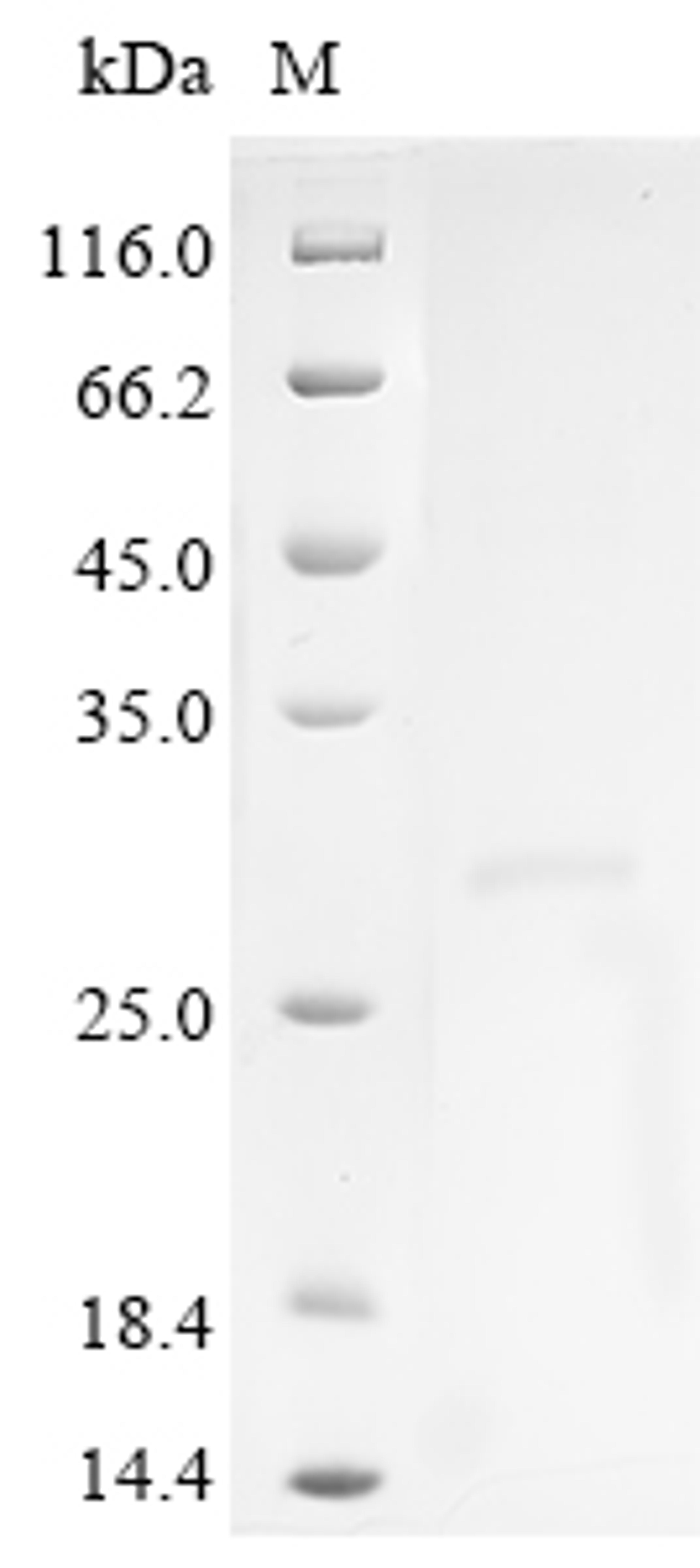 (Tris-Glycine gel) Discontinuous SDS-PAGE (reduced) with 5% enrichment gel and 15% separation gel.