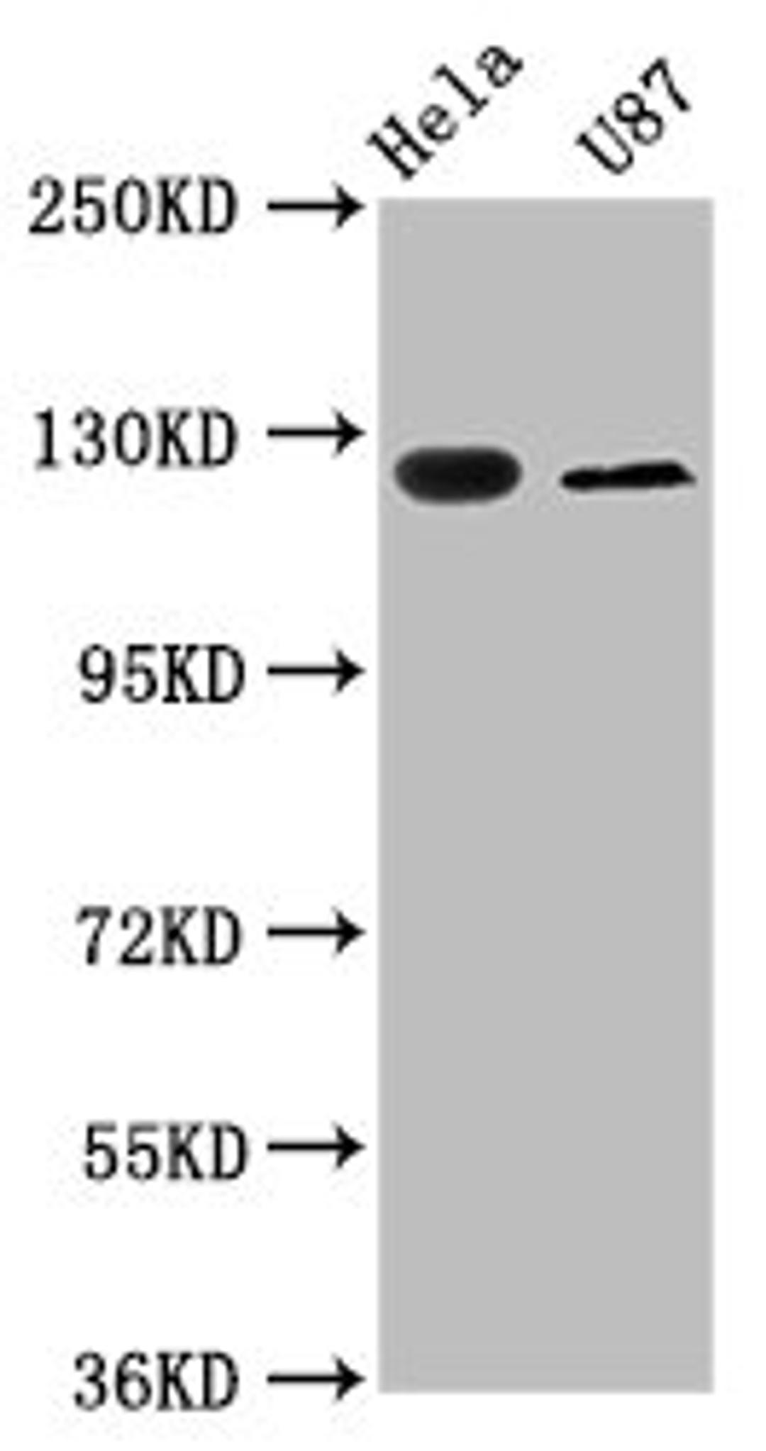 Western Blot. Positive WB detected in: Hela whole cell lysate, U87 whole cell lysate. All lanes: SLC4A5 antibody at 2.7ug/ml. Secondary. Goat polyclonal to rabbit IgG at 1/50000 dilution. Predicted band size: 127, 125, 116, 109, 108, 114, 119 kDa. Observed band size: 127 kDa.