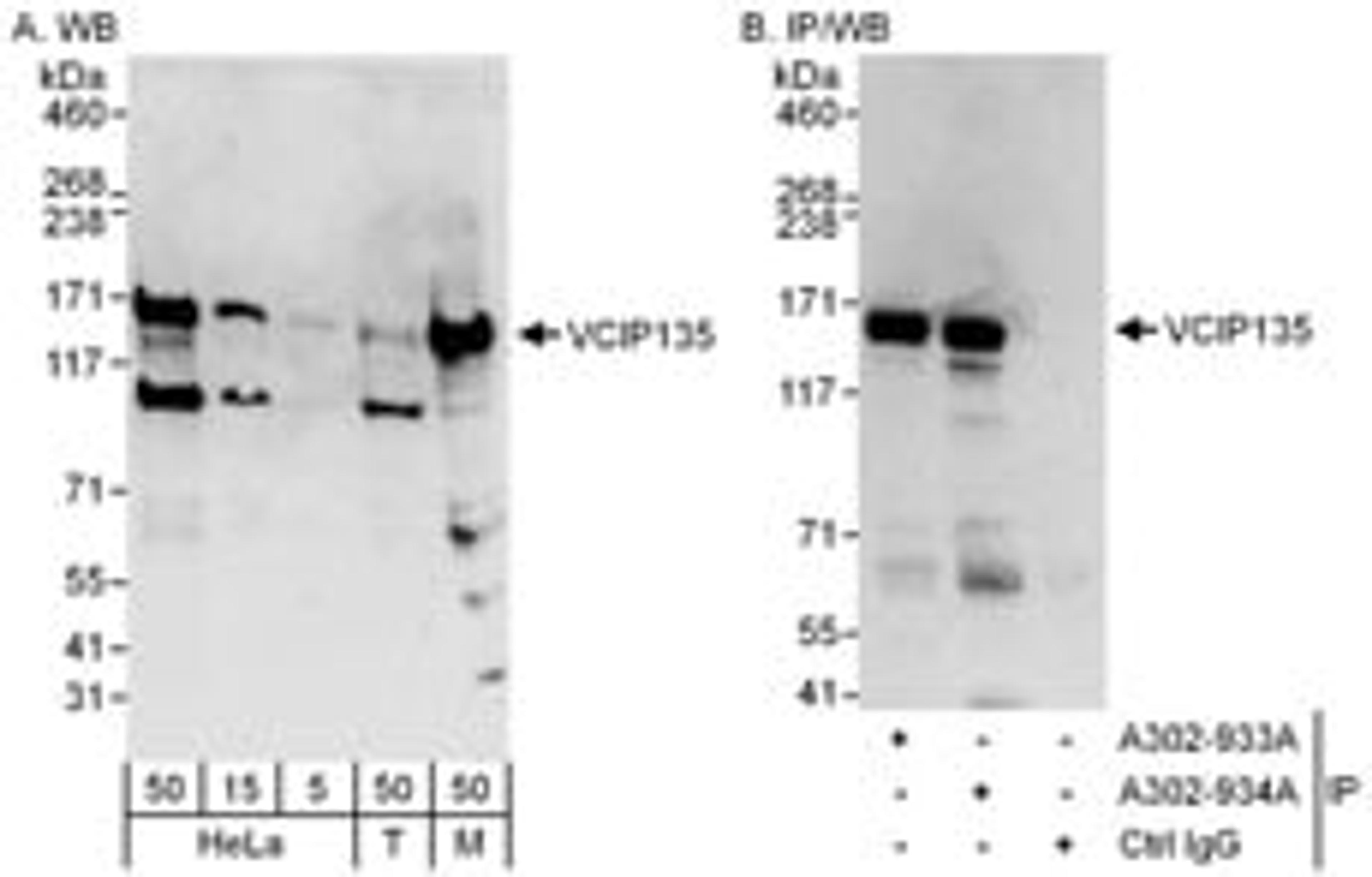 Detection of human and mouse VCIP135 by western blot (h&m) and immunoprecipitation (h).