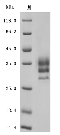 (Tris-Glycine gel) Discontinuous SDS-PAGE (reduced) with 5% enrichment gel and 15% separation gel.