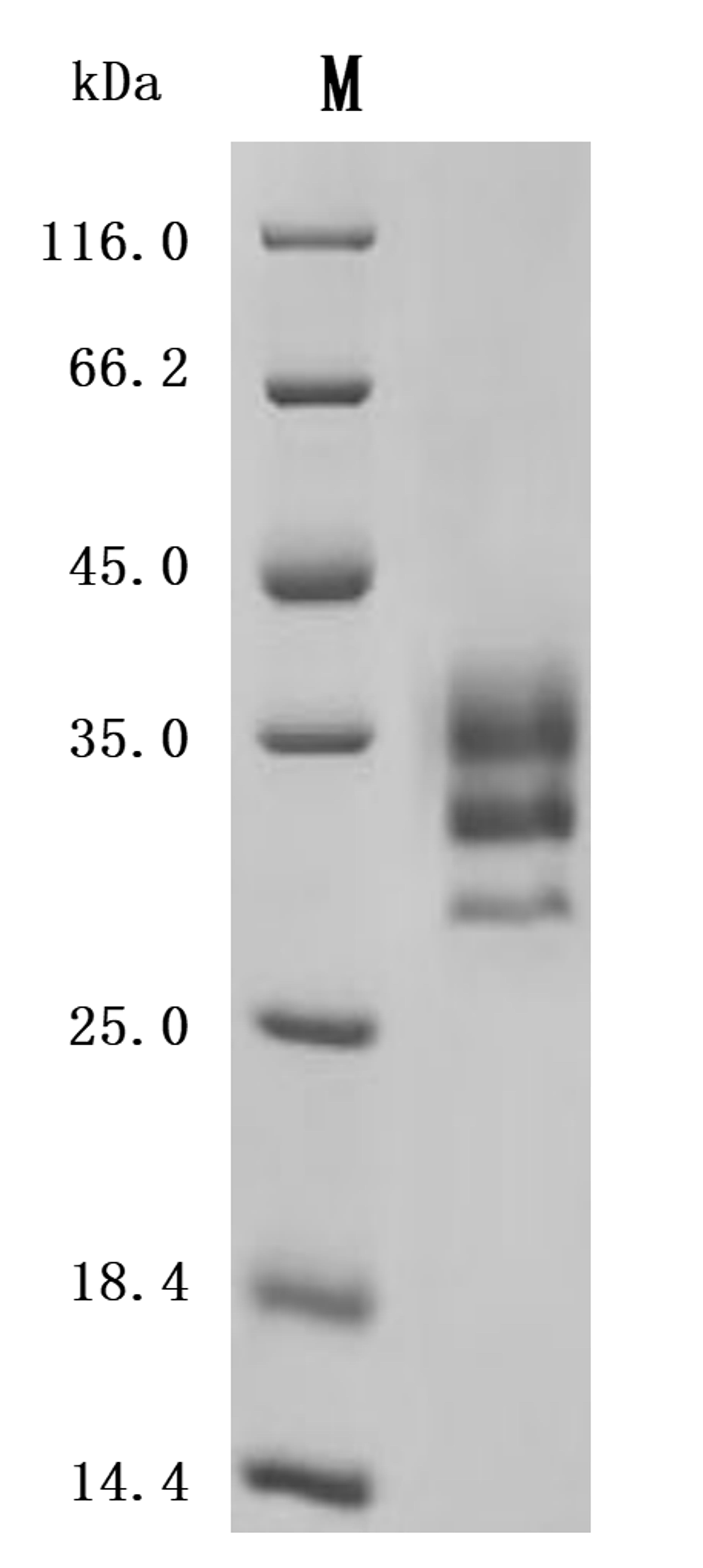 (Tris-Glycine gel) Discontinuous SDS-PAGE (reduced) with 5% enrichment gel and 15% separation gel.