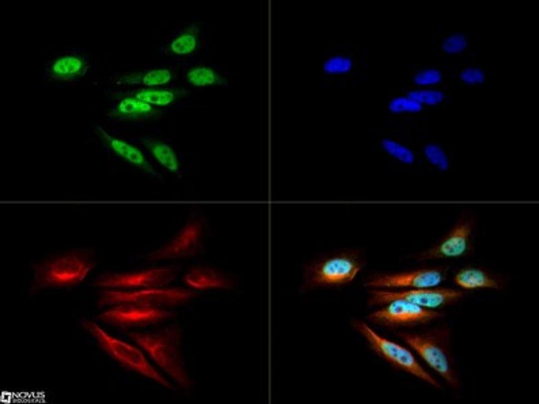 Immunocytochemistry/Immunofluorescence: DNMT1 Antibody [NB100-264] - The Dnmt1 antibody was tested in HeLa cells at a 1:50 dilution against Dylight 488 (Green). Alpha-tubulin and nuclei were counterstained against Dylight 550 (Red) and DAPI (Blue), respectively.