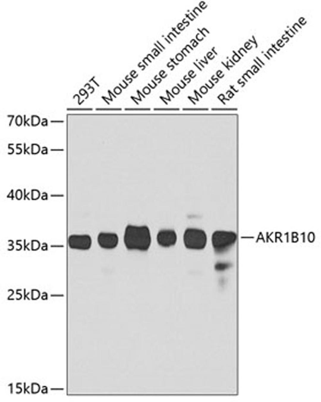 Western blot - AKR1B10 antibody (A7823)