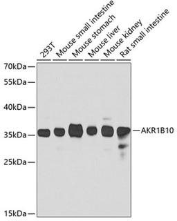 Western blot - AKR1B10 antibody (A7823)