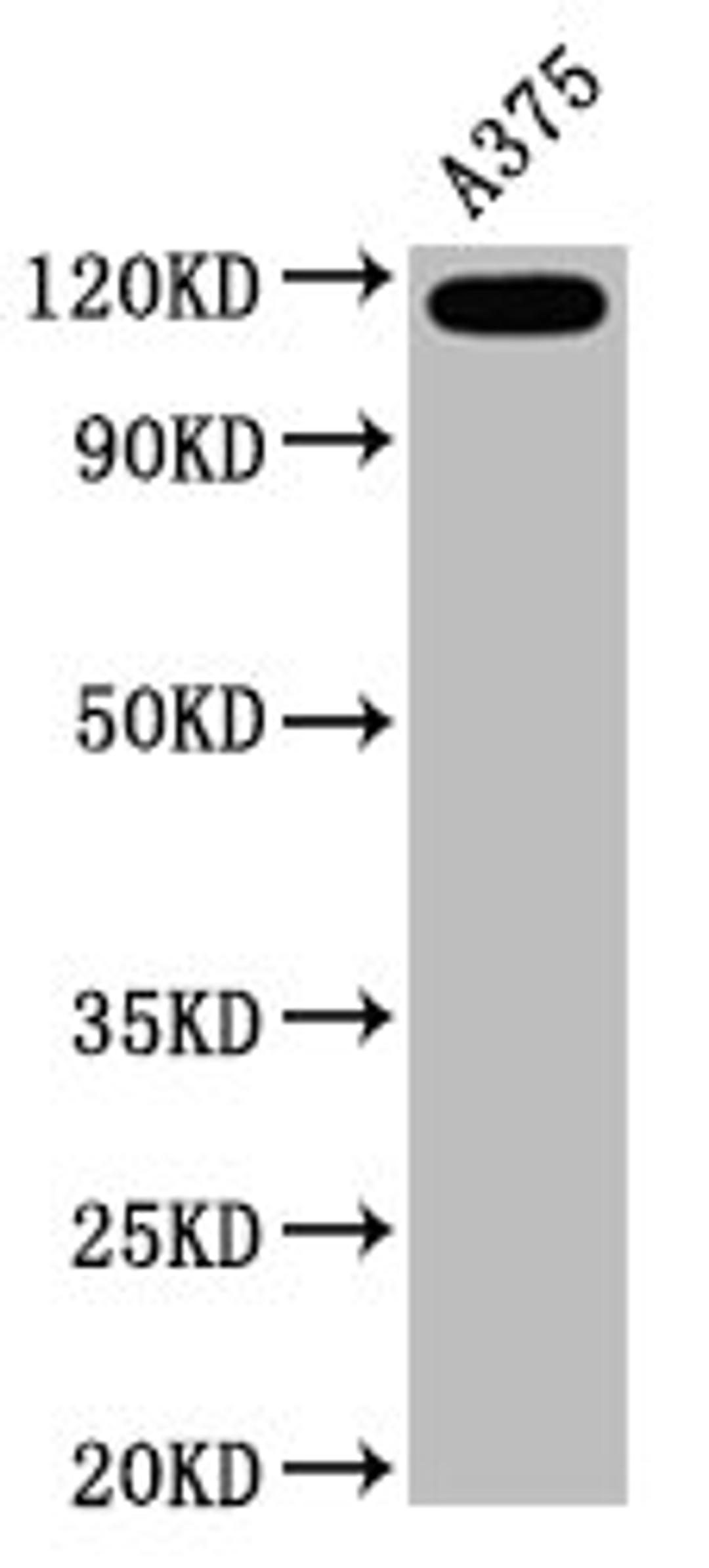 Western Blot. Positive WB detected in A375 whole cell lysate. All lanes CD146 antibody at 0.6μg/ml. Secondary. Goat polyclonal to rabbit IgG at 1/50000 dilution. Predicted band size: 72 KDa. Observed band size: 120 KDa. 