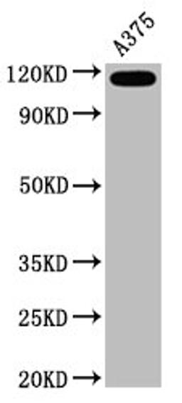 Western Blot. Positive WB detected in A375 whole cell lysate. All lanes CD146 antibody at 0.6μg/ml. Secondary. Goat polyclonal to rabbit IgG at 1/50000 dilution. Predicted band size: 72 KDa. Observed band size: 120 KDa. 
