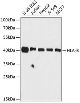 Western blot - HLA-B antibody (A1285)