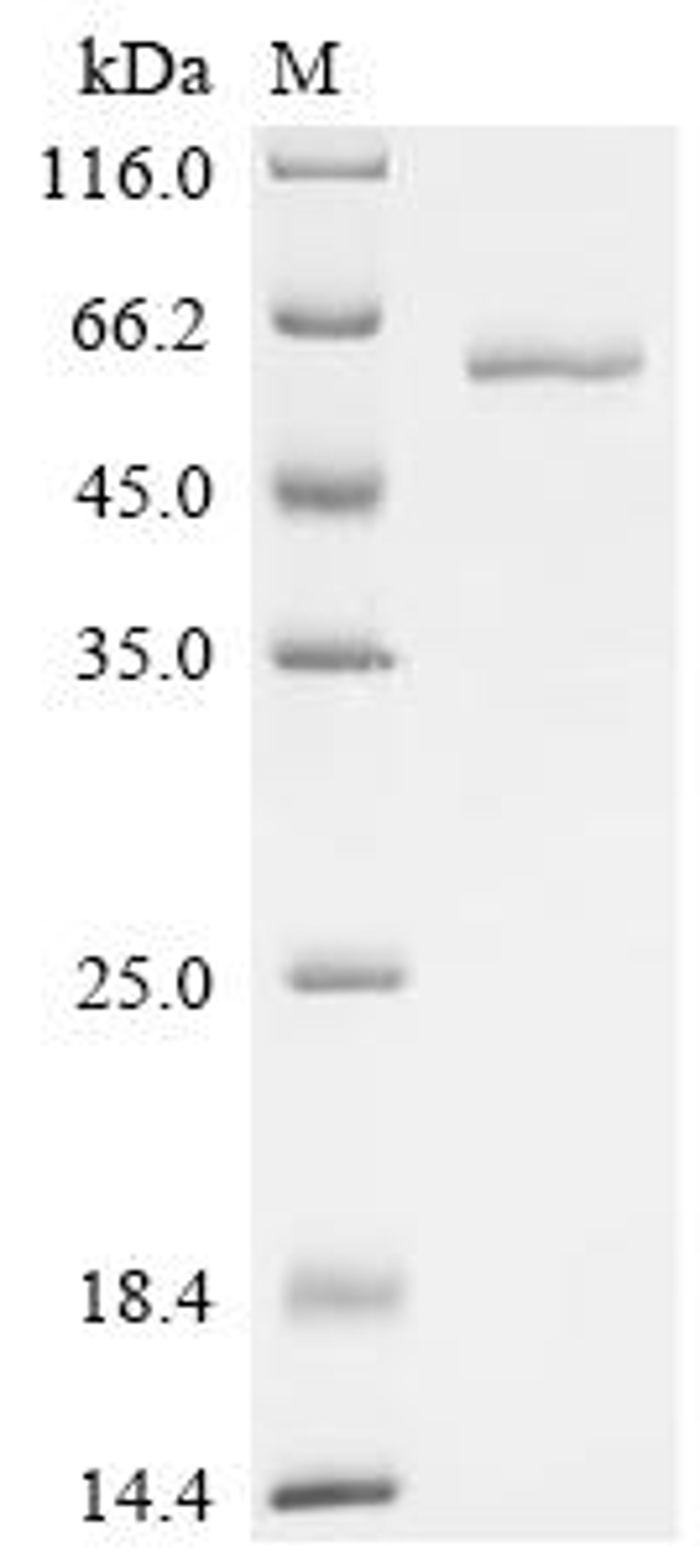 (Tris-Glycine gel) Discontinuous SDS-PAGE (reduced) with 5% enrichment gel and 15% separation gel.