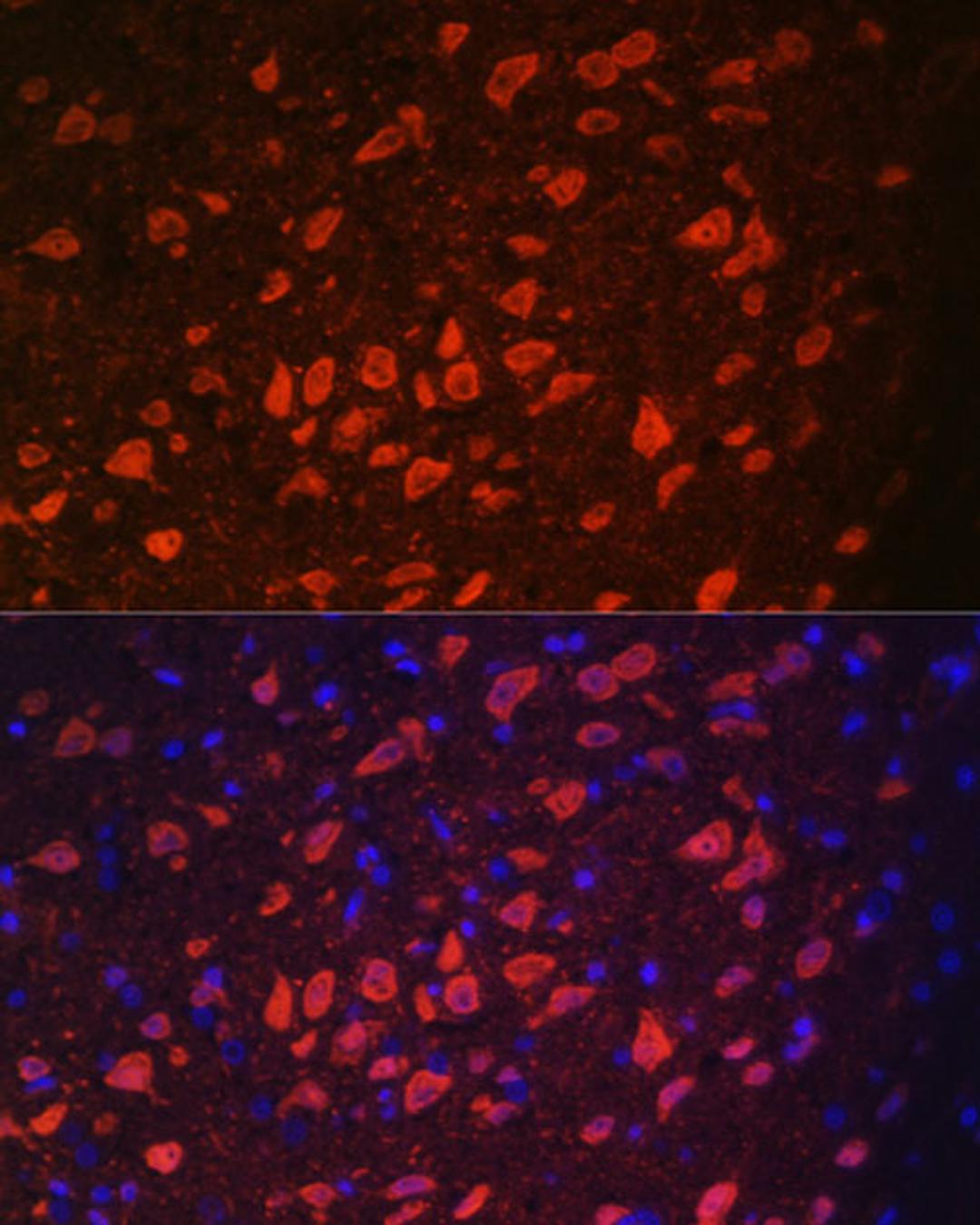 Immunofluorescence - TRPM2 antibody (A6137)