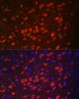 Immunofluorescence - TRPM2 antibody (A6137)