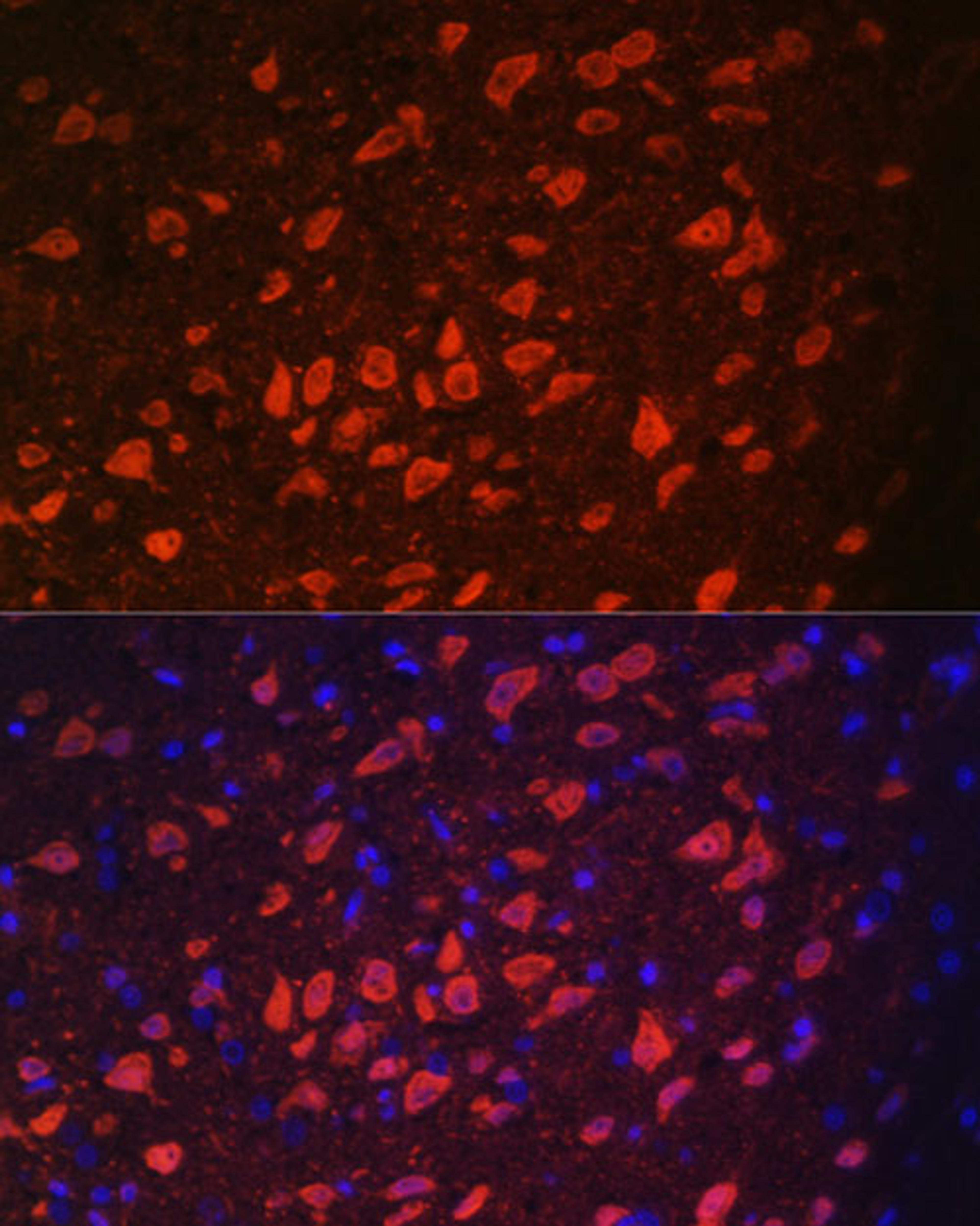 Immunofluorescence - TRPM2 antibody (A6137)