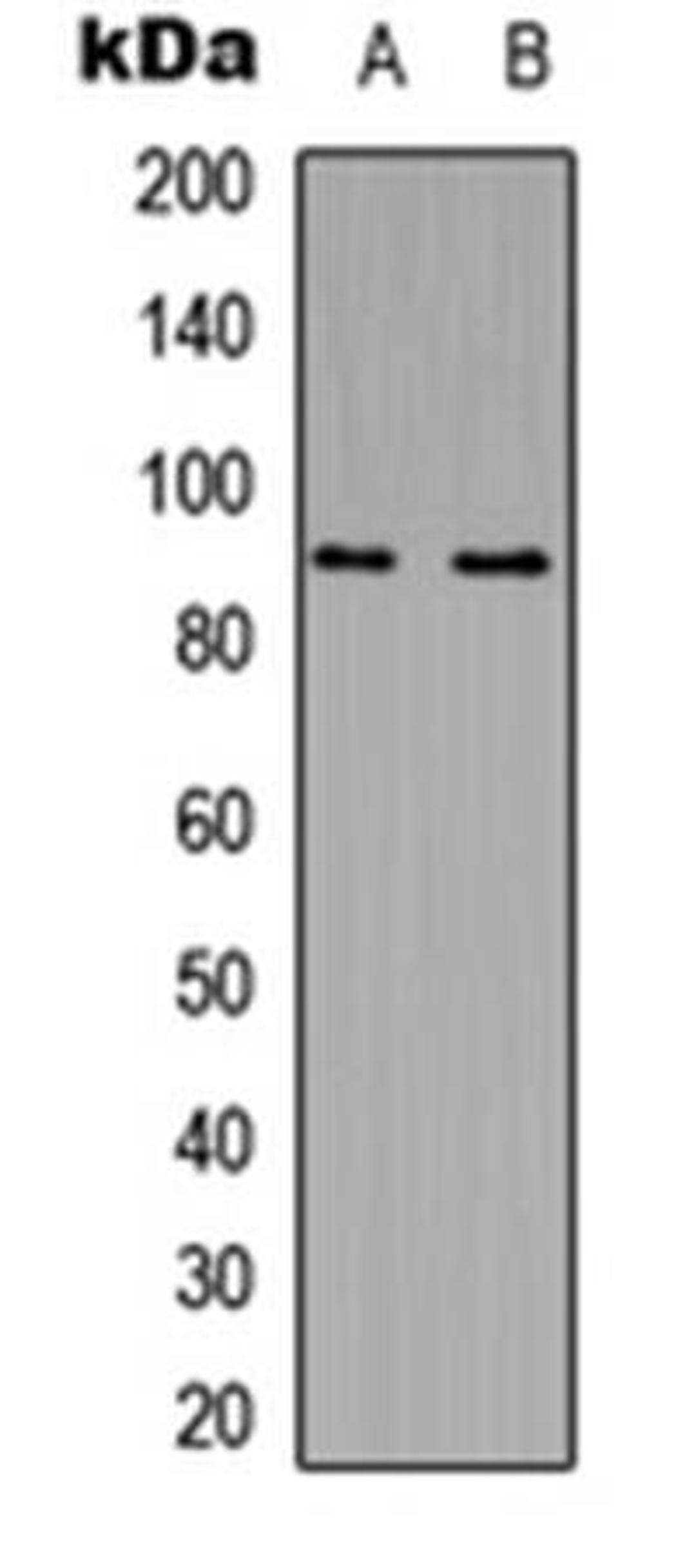 Western blot analysis of Jurkat (Lane1), NIH3T3 (Lane2) whole cell using MARK2 antibody