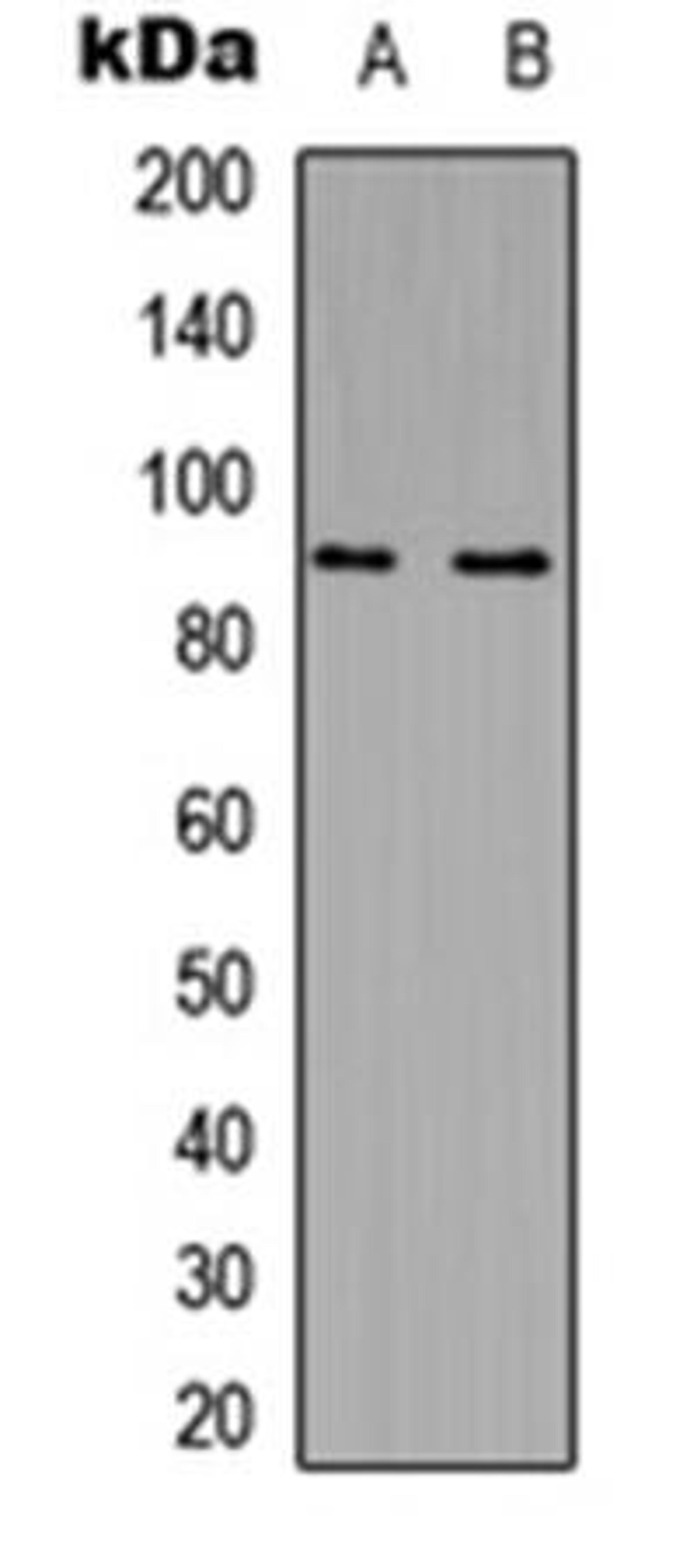 Western blot analysis of Jurkat (Lane1), NIH3T3 (Lane2) whole cell using MARK2 antibody