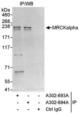 Detection of human MRCKalpha by western blot of immunoprecipitates.