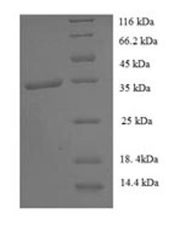 (Tris-Glycine gel) Discontinuous SDS-PAGE (reduced) with 5% enrichment gel and 15% separation gel.