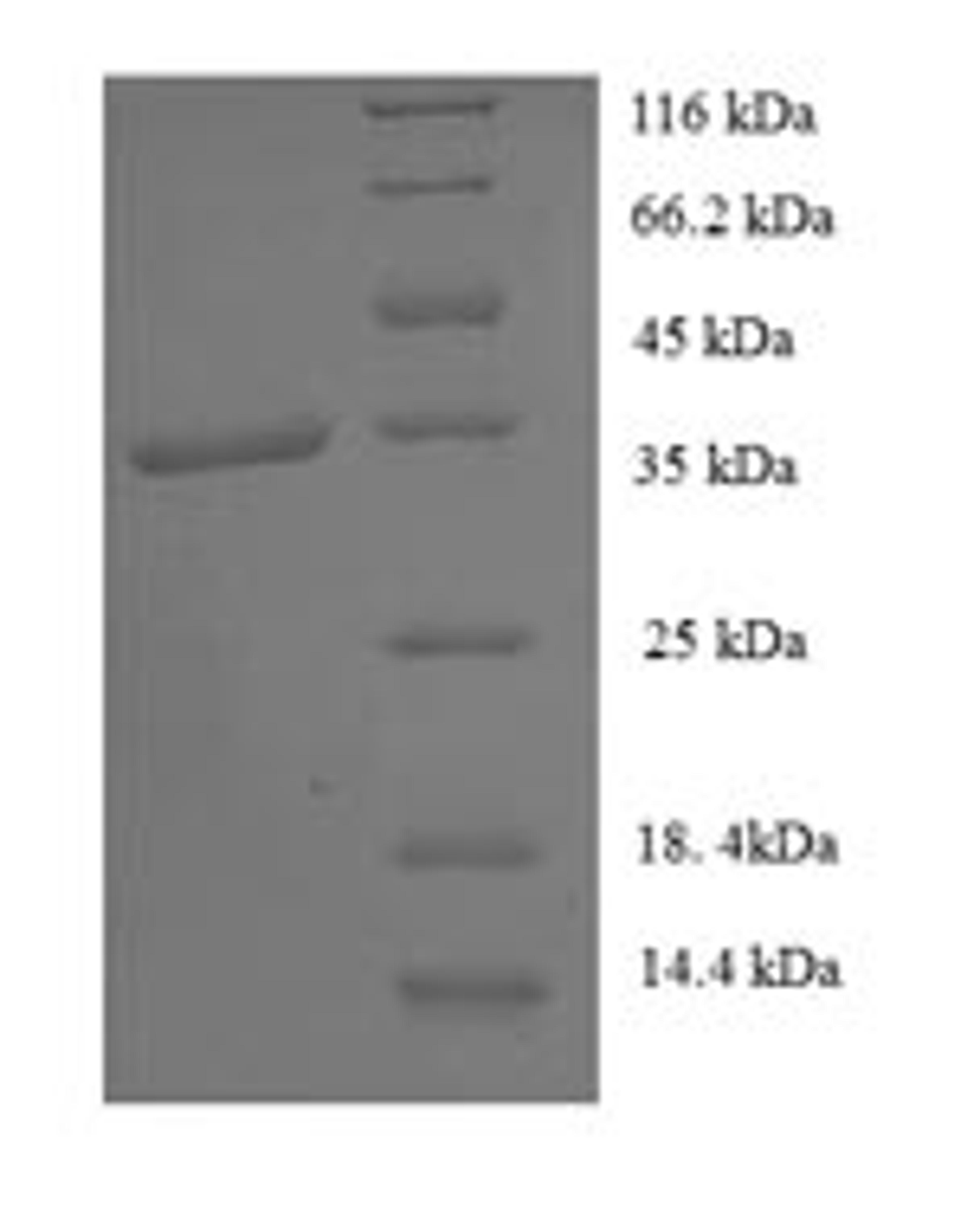 (Tris-Glycine gel) Discontinuous SDS-PAGE (reduced) with 5% enrichment gel and 15% separation gel.