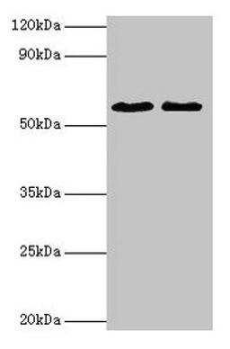 Western blot. All lanes: ESR2 antibody at 2µg/ml. Lane 1: Mouse brain tissue. Lane 2: PC-3 whole cell lysate. Secondary. Goat polyclonal to rabbit IgG at 1/10000 dilution. Predicted band size: 60, 56, 36, 58, 55, 53, 49, 42, 54 kDa. Observed band size: 60 kDa