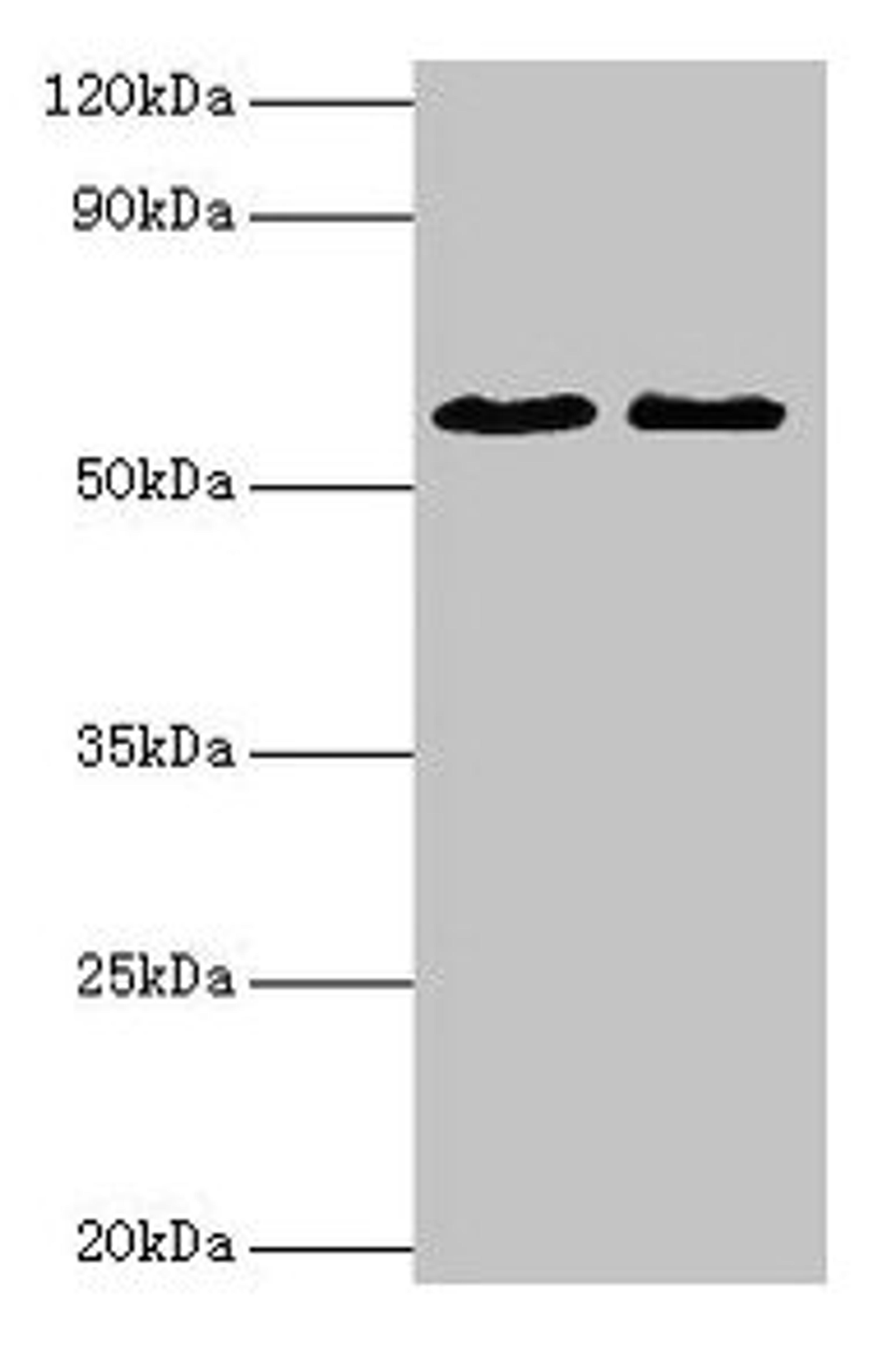 Western blot. All lanes: ESR2 antibody at 2µg/ml. Lane 1: Mouse brain tissue. Lane 2: PC-3 whole cell lysate. Secondary. Goat polyclonal to rabbit IgG at 1/10000 dilution. Predicted band size: 60, 56, 36, 58, 55, 53, 49, 42, 54 kDa. Observed band size: 60 kDa