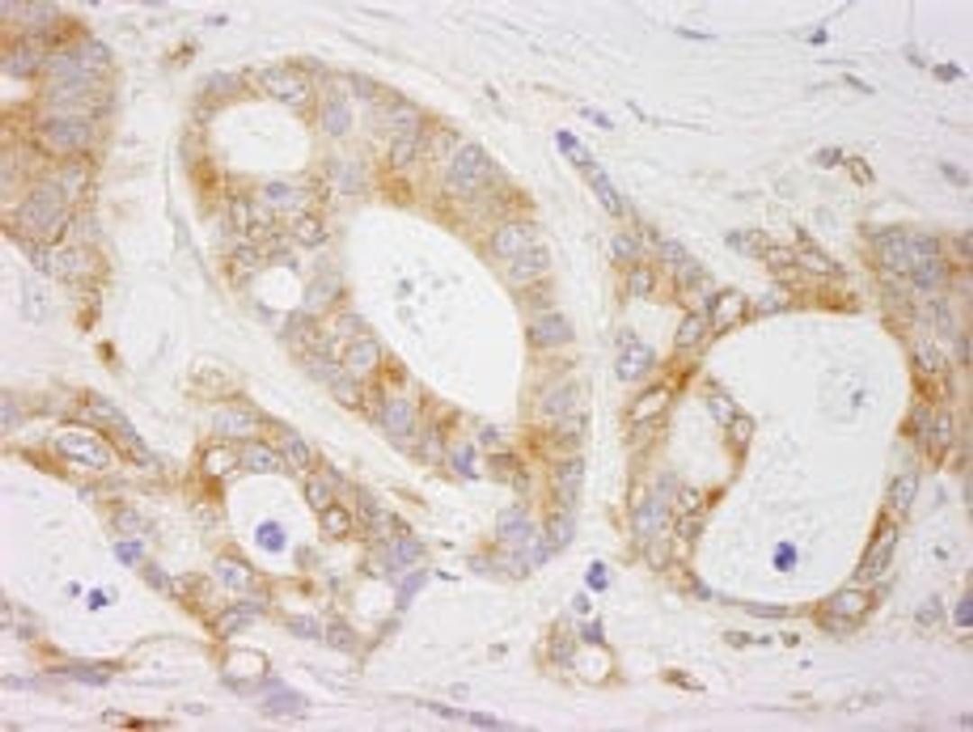 Detection of human EML4 by immunohistochemistry.